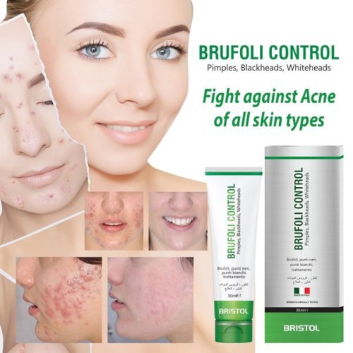 BRUFOLI CONTROL Pimples, BlackHeads, WhiteHeads, Acne (30ml)