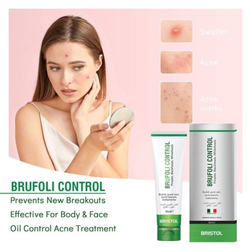 BRUFOLI CONTROL Pimples, BlackHeads, WhiteHeads, Acne (30ml)